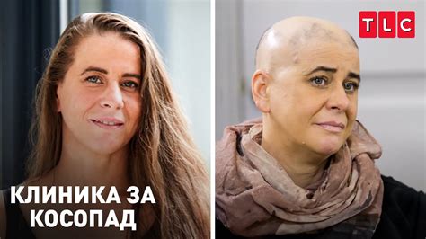 Окапах след катастрофа | Клиника за косопад - YouTube