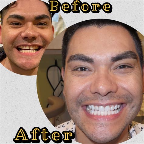 Dentist In Irving, TX - Dental Artistry Irving