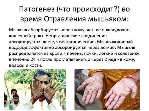 Мышьяк Мышьяк лат Arsenicum обозначается символом As