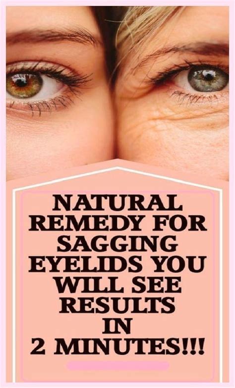 Sagging Eyelids in 2024 | Natural remedies, Remedies, Wrinkles