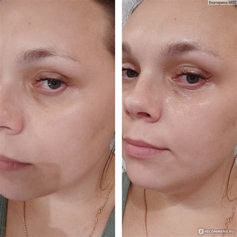 Сыворотка-спрей MIXIT Lifting Face Spray Serum Для лица с лифтинг ...