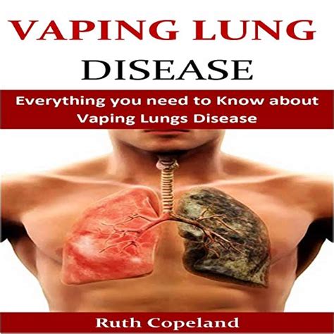 Vaping Lung Disease by Ruth Copeland - Audiobook - Audible.com