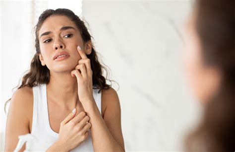 Chin Breakouts: Everything You Need To Know | Averr Aglow®
