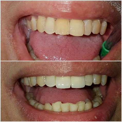 FANO Dental GROUP | Cebu City