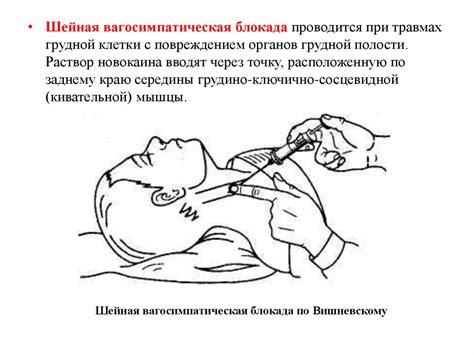 Обезболивание. Виды обезболивания. Определение и классификация наркоза ...