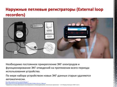 Методы диагностики нарушений сердечного ритма и проводимости ...