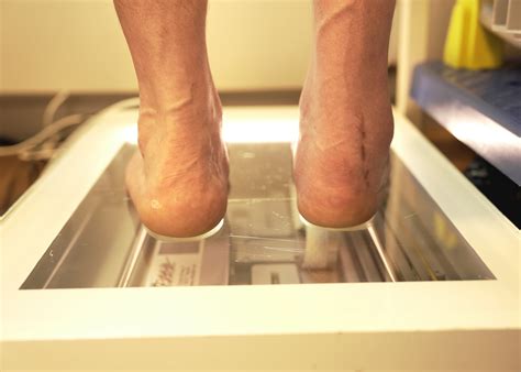 Schuhe fürs Leben nach einem Arbeitsunfall - BGHW eMagazin