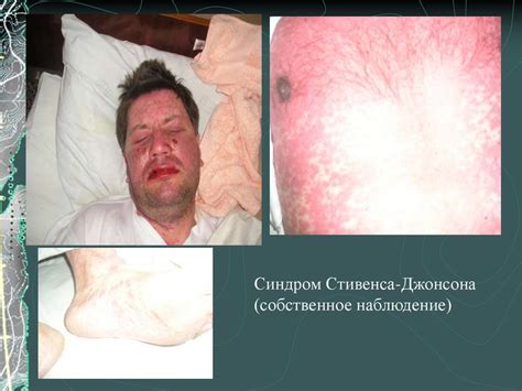 Методы диагностики инфекционных болезней. Основные принципы лечения ...