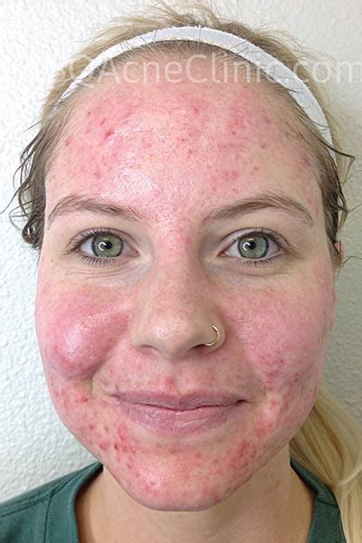 Clear Path Skin Care & Acne Clinic - Clear Path Skin Care & Acne Clinic