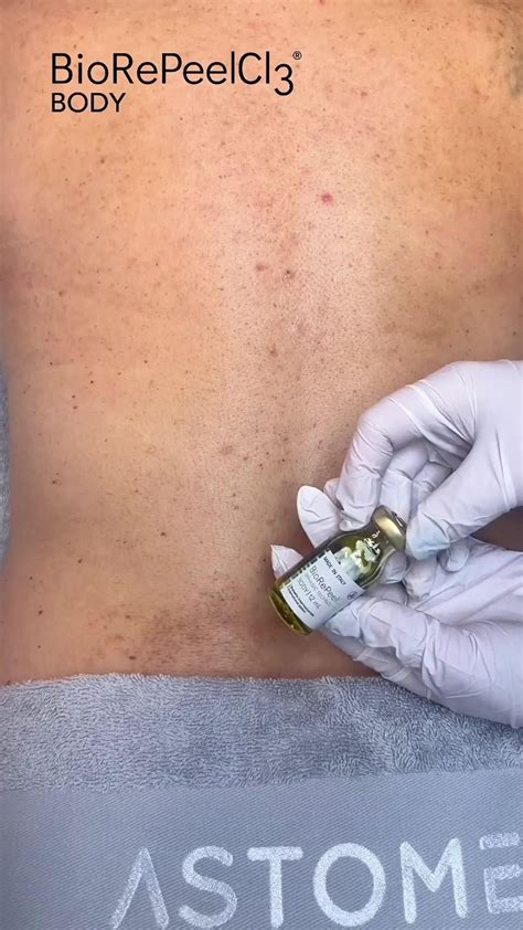 Mesotherapy for face / мезотерапия для кожи лица in 2024 | Cosmetology ...