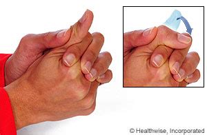 Thumb Arthritis: Exercises | Kaiser Permanente