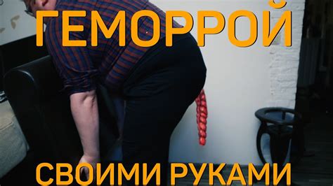 Своими Руками - ГЕМОРРОЙ - YouTube