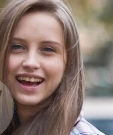 What did Kiushkina Anastasia look like before plastic surgery ...