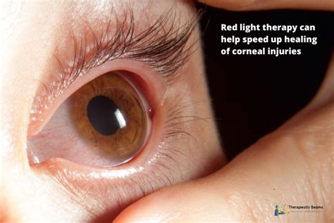 red light therapy  eyes improve eye health function appearance