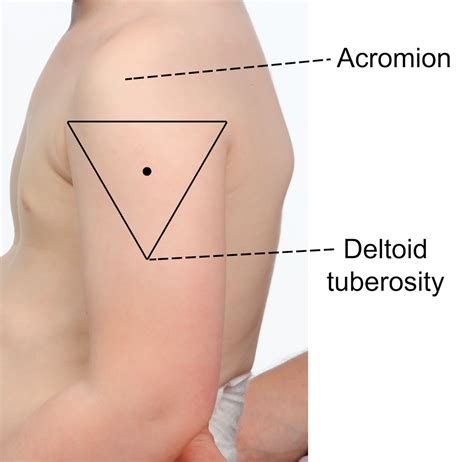 Im Injection Deltoid What Variables Should Inform Needle Length Choice