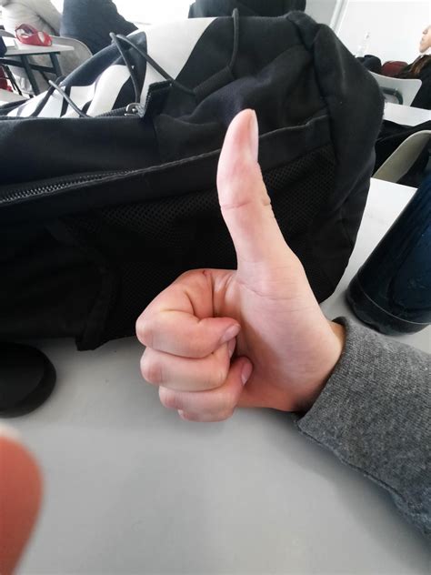 The all-time thumb war champion : r/AbsoluteUnits