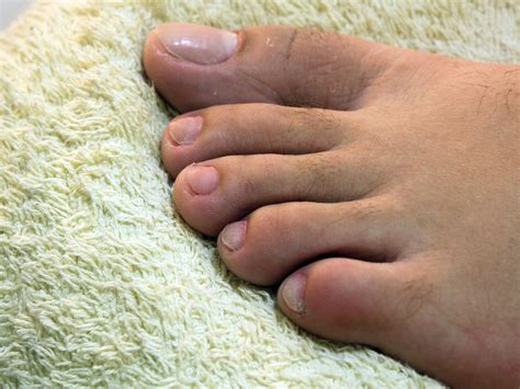 What Toenails Should Look Like at Robert Spikes blog
