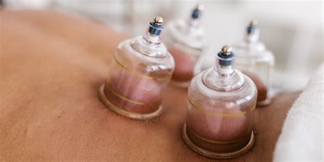 Here's Why Cupping Therapy Is My Favorite Workout Recovery | POPSUGAR