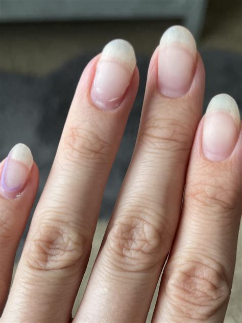 Are all these nails lifting or does this look normal? : r/DIYGelNails