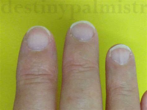 Normal Fingernails