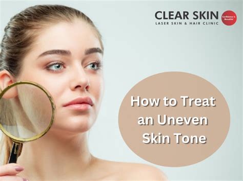 How to Treat an Uneven Skin Tone? by Atharv Parekh on Dribbble