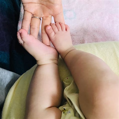 赤ちゃんの太ももの左右シワの違いから乳児股関節脱臼の疑いありと健診で診断され東大病院で精密検査...レントゲン診察の結果はいかに。 | えどりずむ