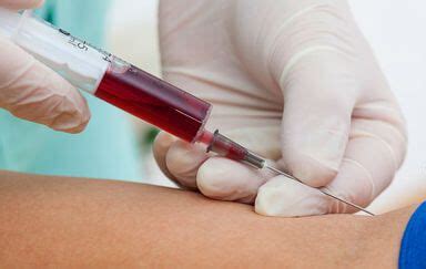 how to know iron level