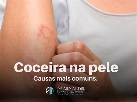 🩺 Coceiras na pele: causas mais comuns e quando se preocupar