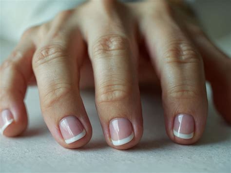 Heberden's nodes and Bouchard's nodes | Medicare Health Center
