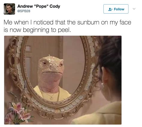23 Things That Are Way Too Real If You Sunburn Easily