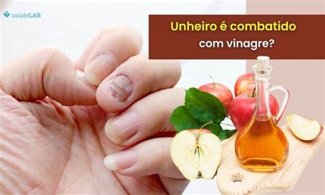 O Que É Bom Para Unheiro