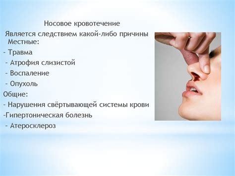 Оториноларингология, как медицинская дисциплина - презентация онлайн