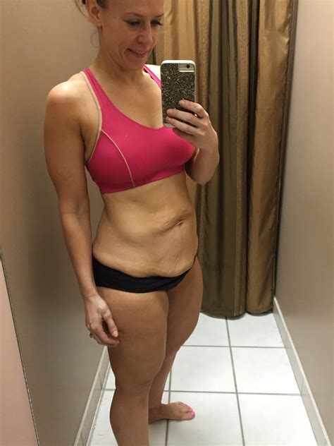 5 ways to lose weight post a C-section | - Diet plan for weight loss