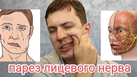 Упражнения для лица - Восстановление после инсульта - YouTube