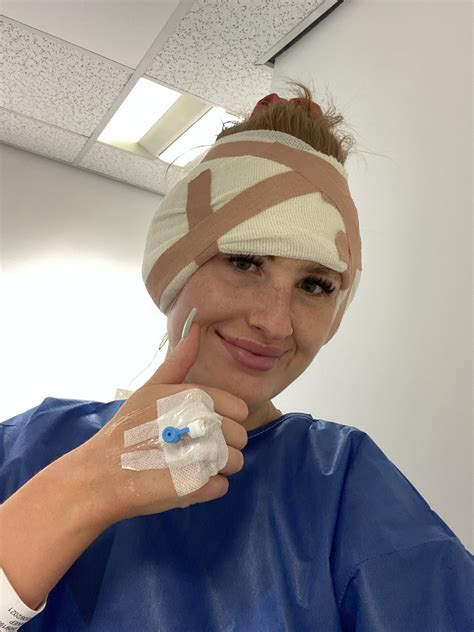 I hated my ears and never wore my hair up - £3k op to have them pinned