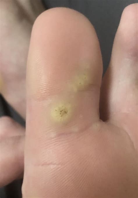 WHAT IS THIS?? My foot has been hurting for like 3 months. thought it