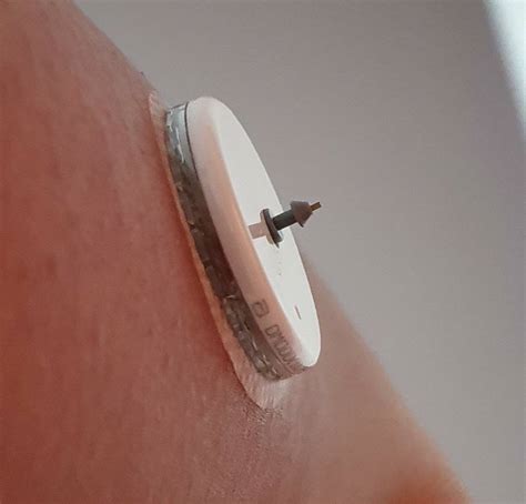 FreeStyle Libre Sensor Failure | Diabetes Forum • The Global Diabetes ...