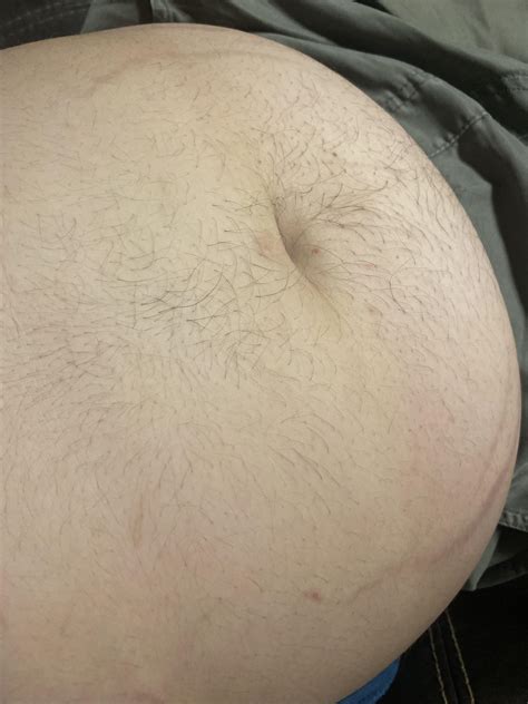 Belly hair growth! : r/TestosteroneKickoff