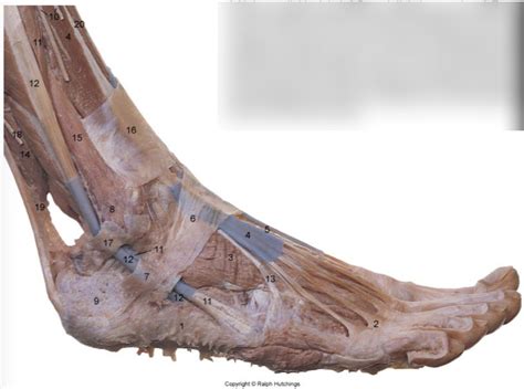 leg  ankle lateral aspect diagram quizlet