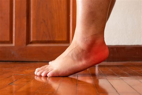 Plantar Fasciitis | Plantar Fasciitis Injection Cortisone | Joint