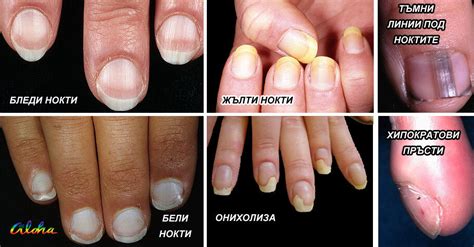 принуждение двадесет ваза жълта кожа на ръцете пират позор бедствие