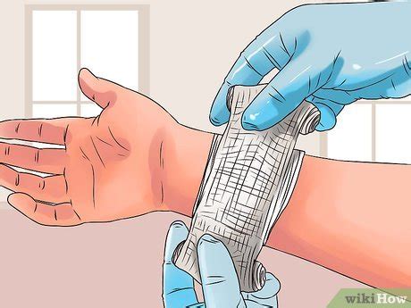 Corte Profundo Que Não Sangra - 4 Formas de Tratar Cortes Profundos - wikiHow