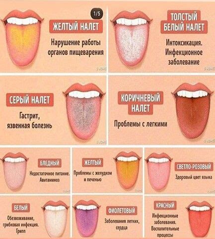 🌿 Покажи мне свой язык | OK.RU | Health, Medicine pictures, Healthy ...