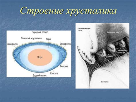 Катаракта – помутнение хрусталика - презентация онлайн
