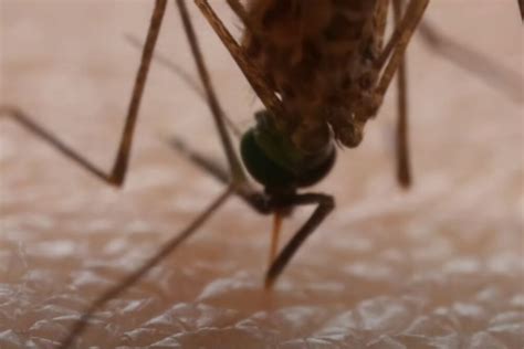 Virus zapadnog Nila simptomi