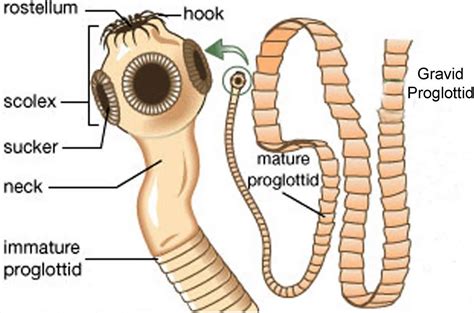 Cysticercosis causes, prevention, symptoms, diagnosis and treatment
