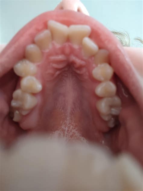 Do my teeth look okay? : r/Teeth