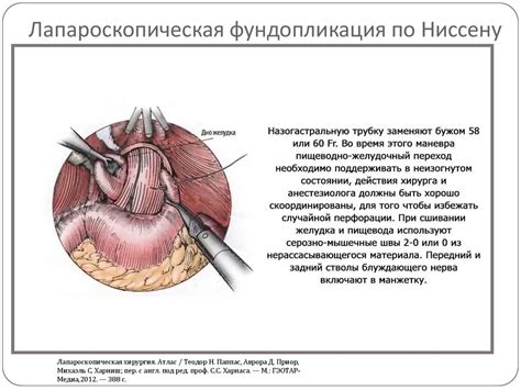 Эндохирургические методы лечения пищевода Барретта - презентация онлайн