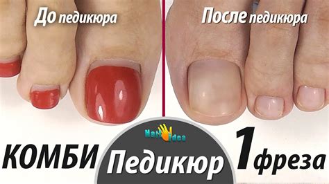ПЕДИКЮР гель лаком КОМБИ 1 фрезой. Техника "Эстетик" Укрепление ...