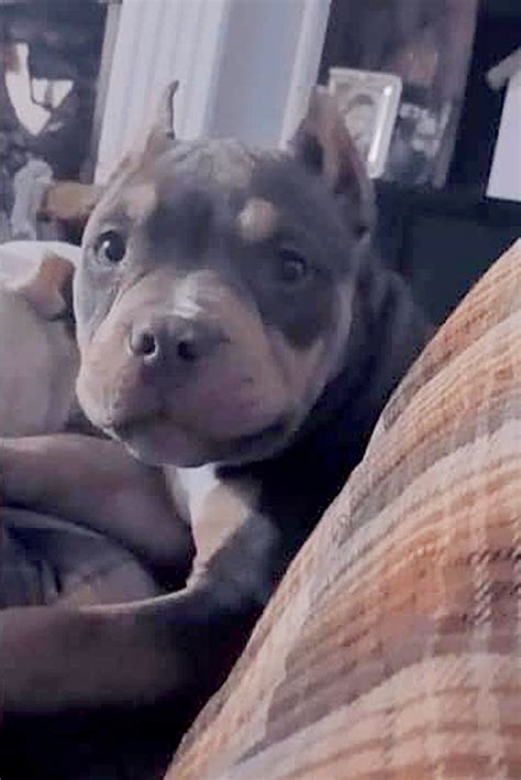 11-year-old mauled by pit bulls gives update from hospital | New York Post